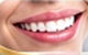 Dental Treatment